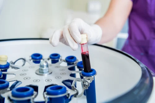 اهمیت کیت‌های PRP و دستگاه سانتریفیوژ