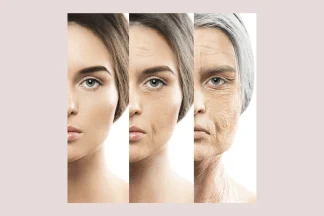 از چه سنی تولید کلاژن پوست کاهش می‌یابد؟ راهنمای پیشگیری و درمان