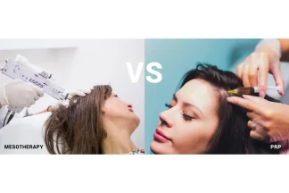 پی آر پی در مقابل مزوژل