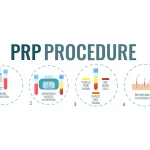 صفر تا صد فرآیند پی آر پی در کلینیک دکتر مهدویه: از مشاوره تا مشاهده نتایج