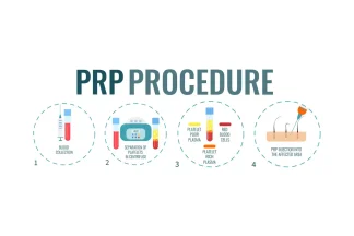 صفر تا صد فرآیند پی آر پی در کلینیک دکتر مهدویه: از مشاوره تا مشاهده نتایج