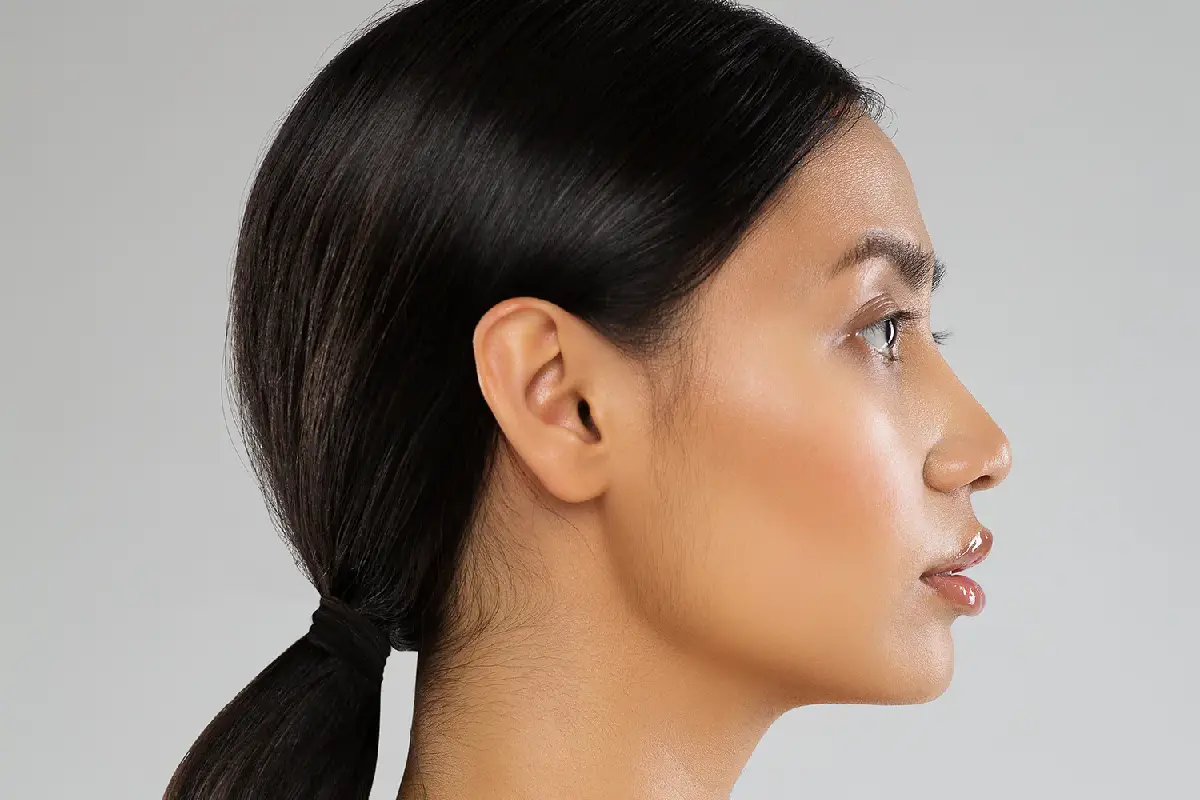 مزایا و فواید لیزر اندولیفت