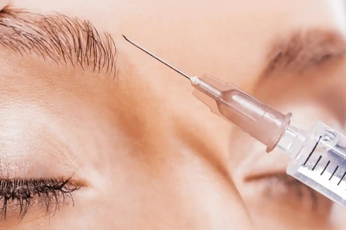 مزایای کلیدی بوتاکس پیشگیرانه در مقایسه با بوتاکس درمانی