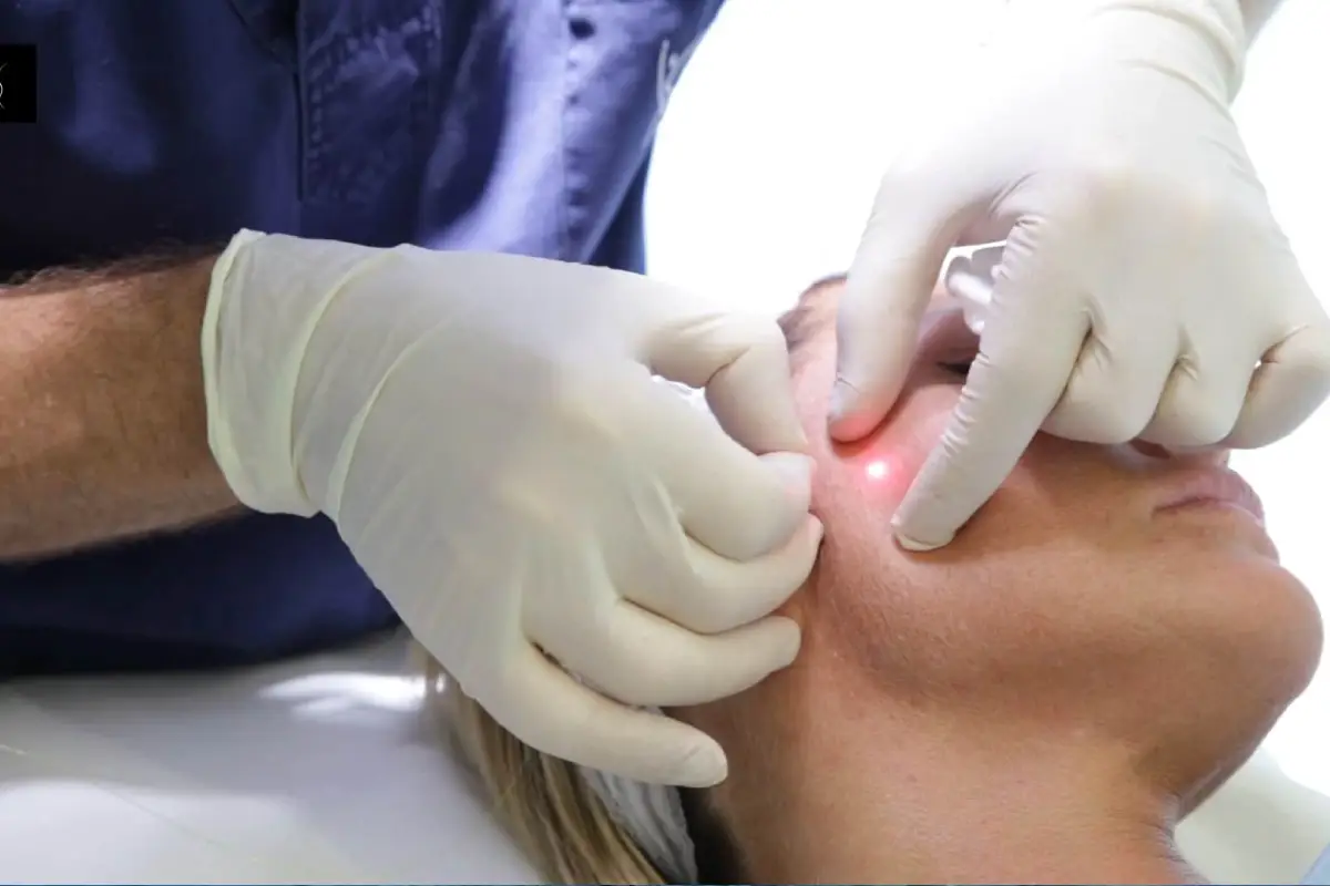 اندولیفت چیست؟